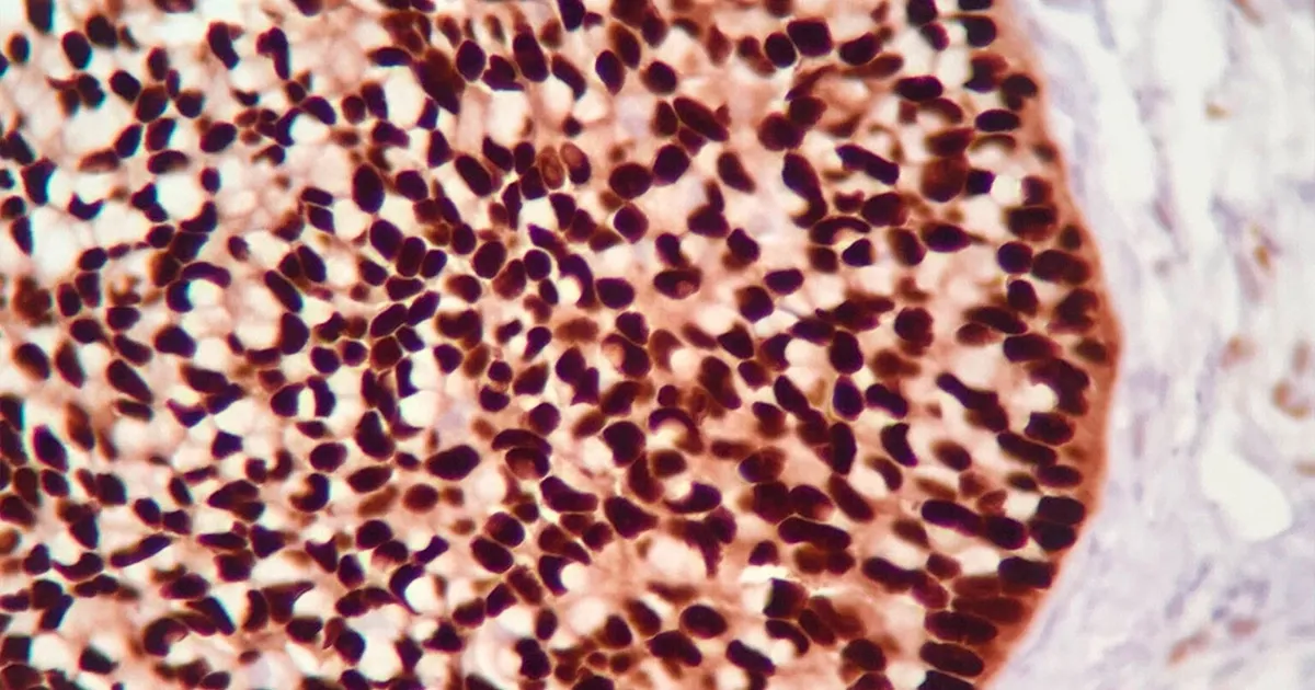 Laboratorio de Inmunohistoquímica