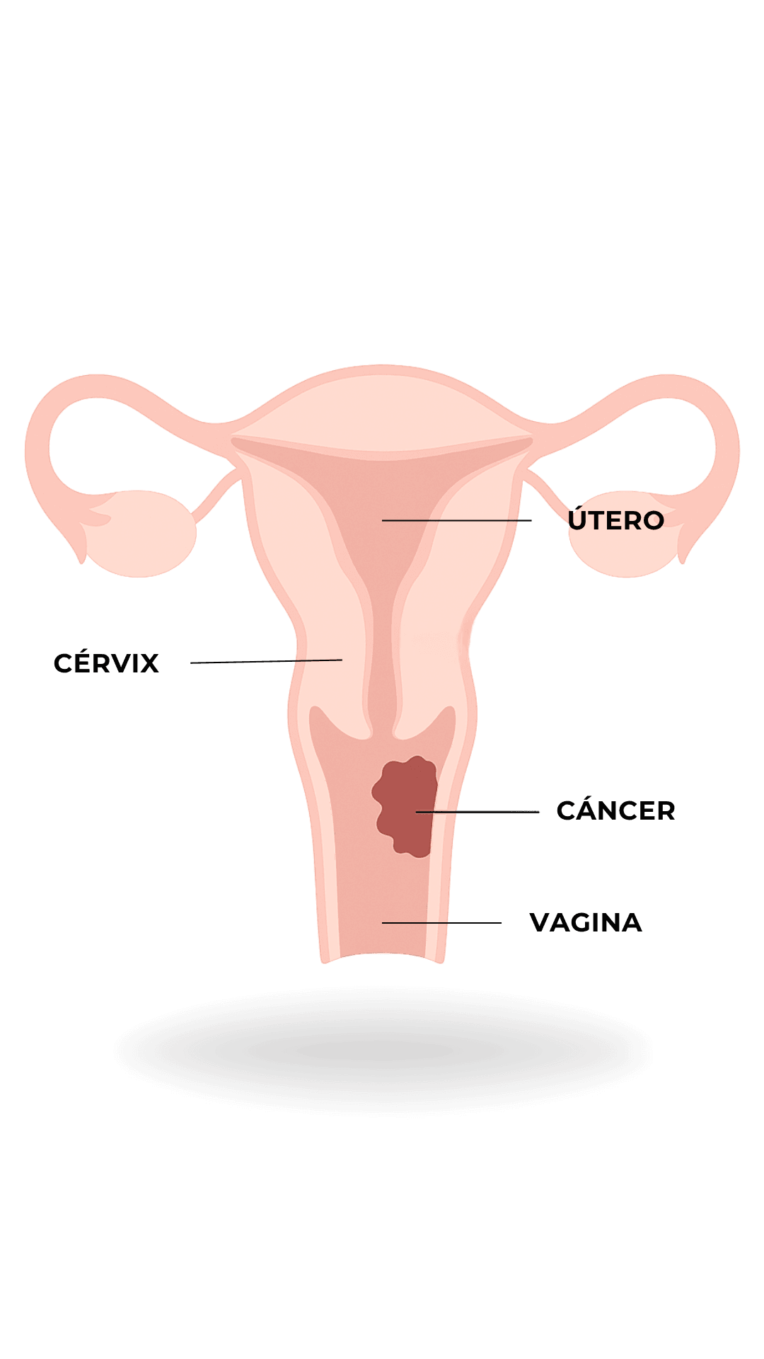 Anatomía - Cáncer de Cuello Uterino