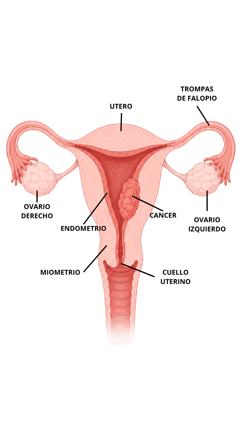 Anatomía - Cáncer de endometrio