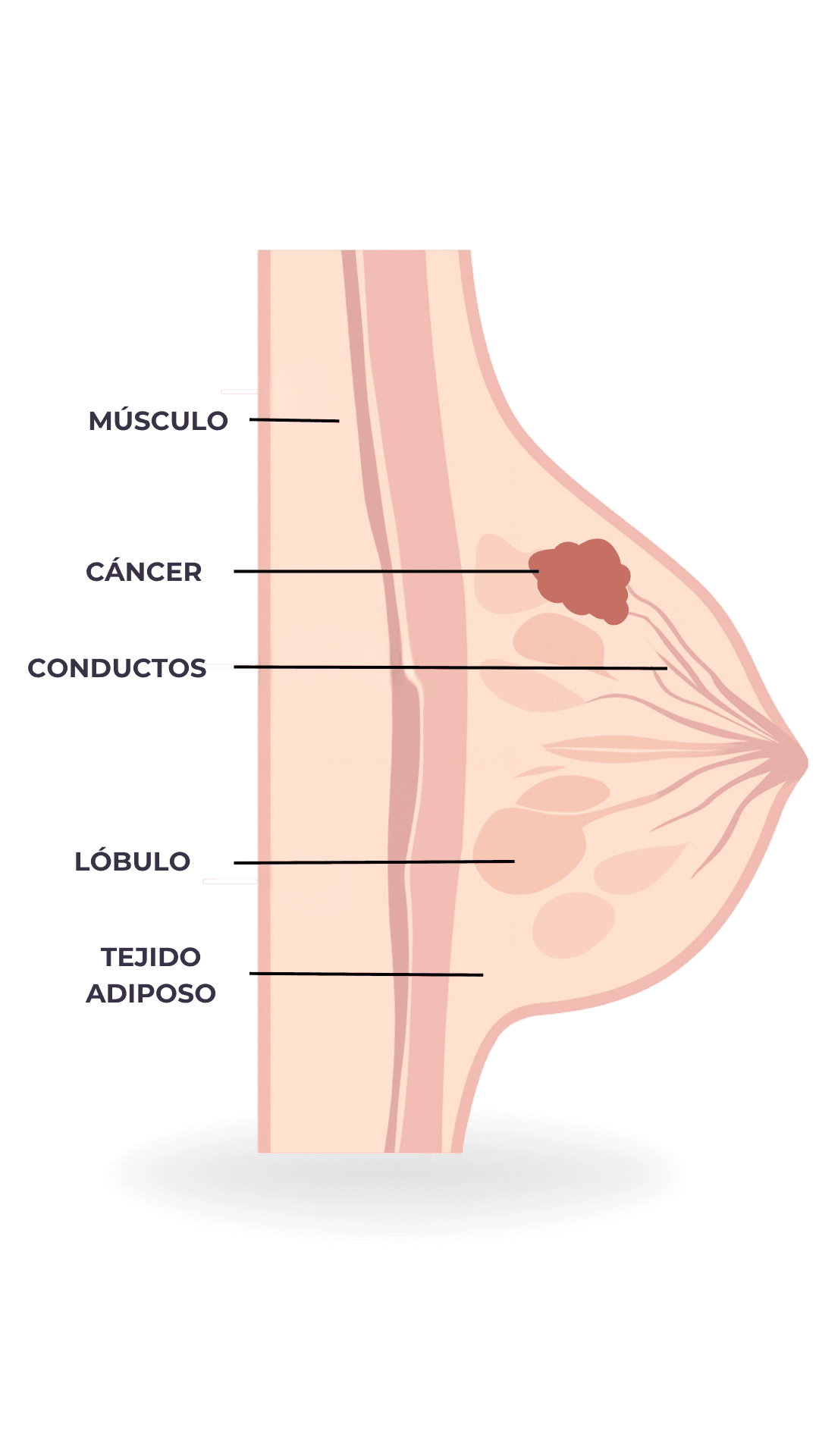 Anatomía - Cáncer de mama
