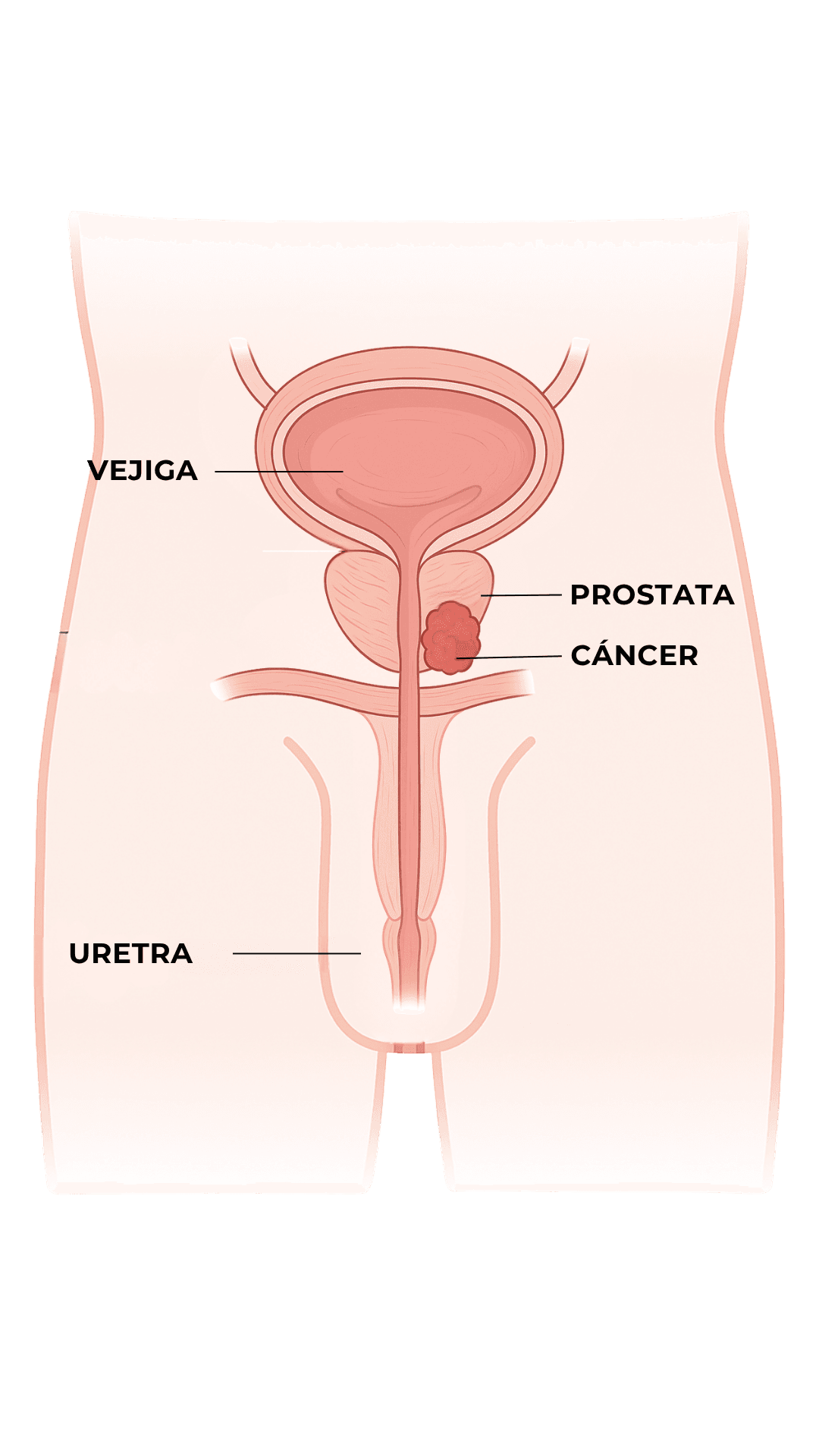 Anatomía - Cáncer de Próstata