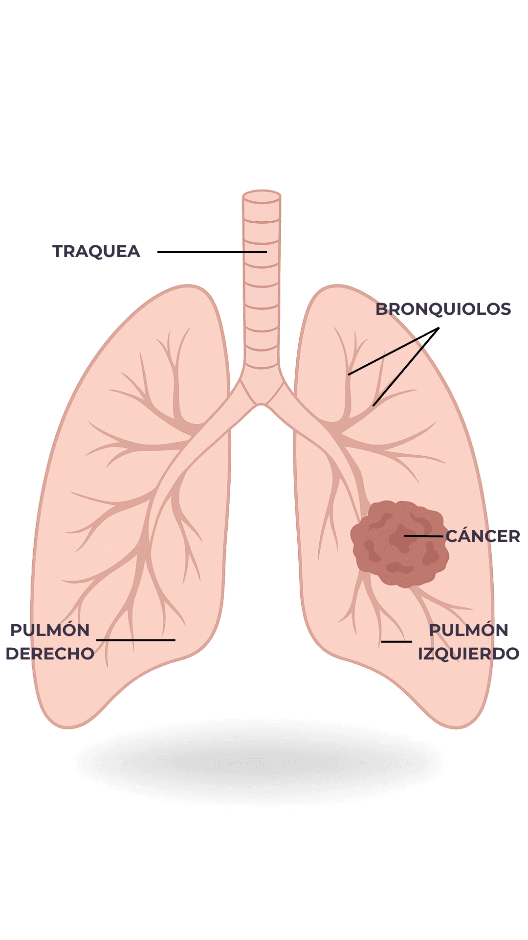 Anatomía - Cáncer de Pulmón