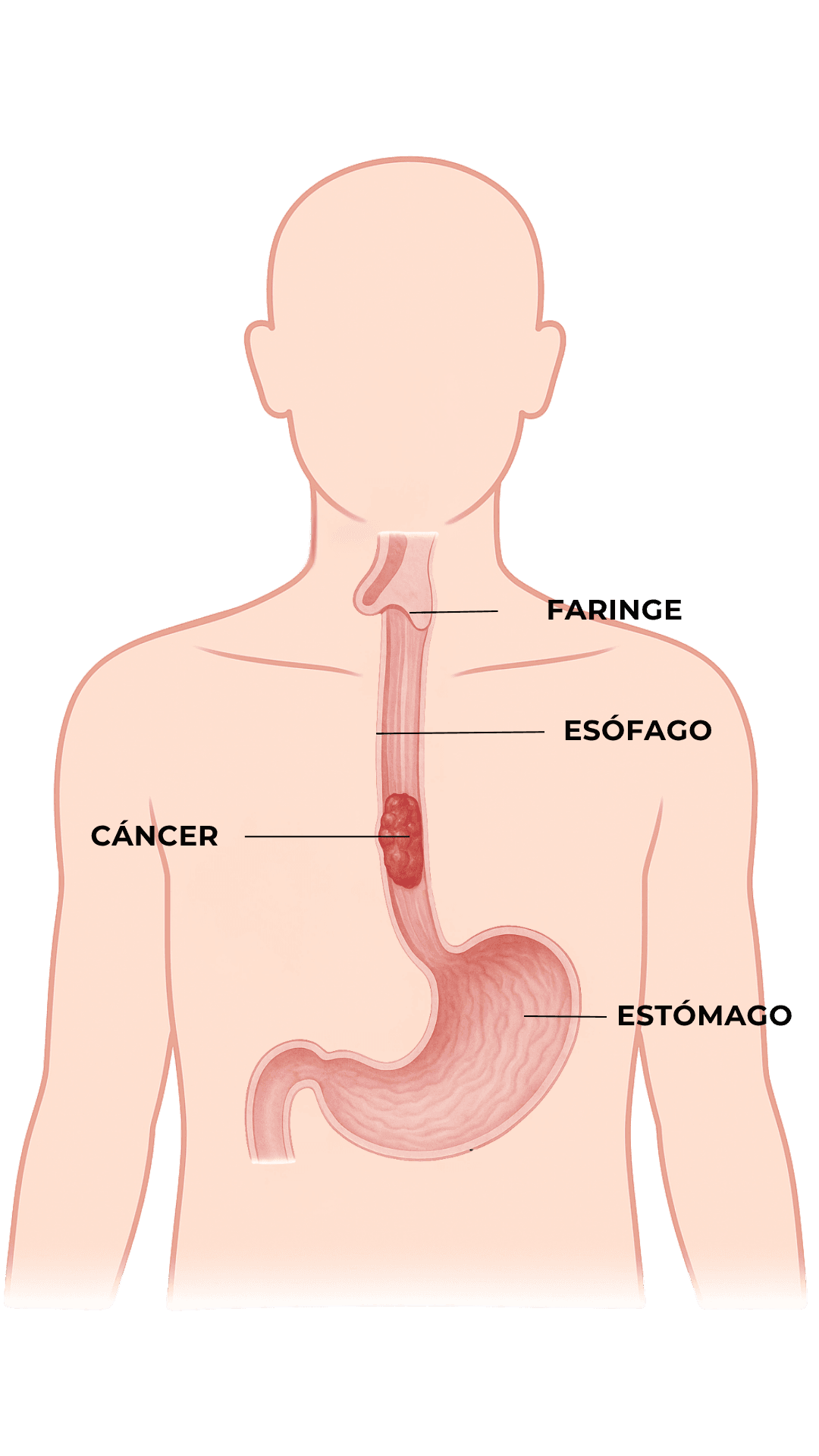 Anatomía - Cáncer de Esófago