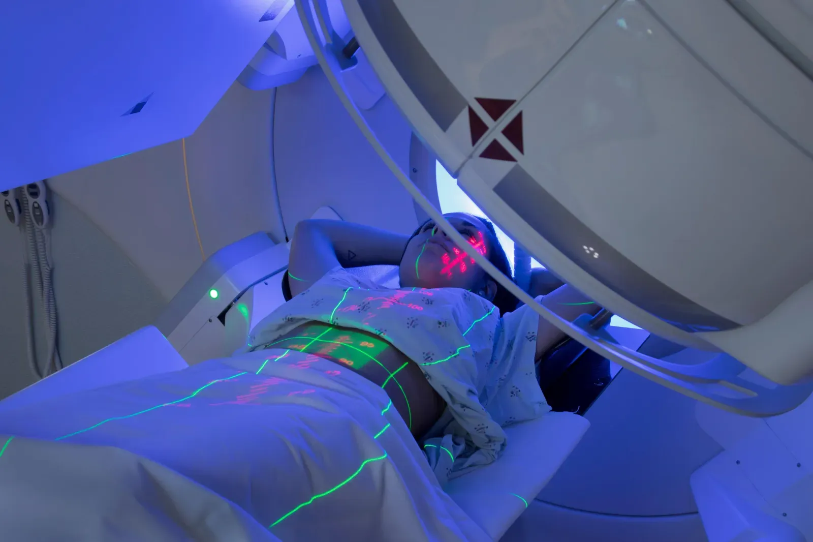 Radioterapia