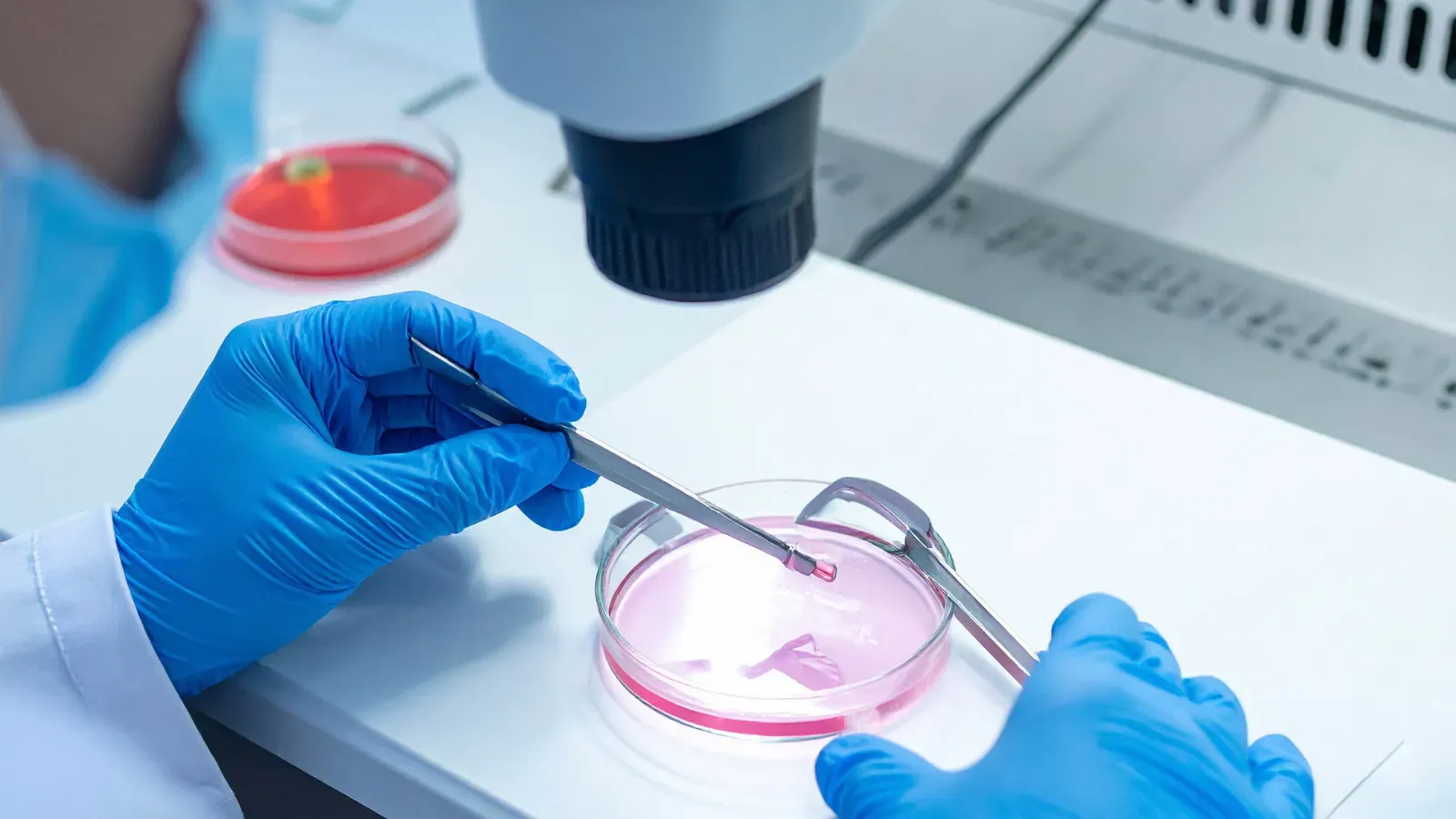 Donante de esperma tenía una mutación que eleva el riesgo de cáncer hasta 90% y al menos 200 niños nacieron con ese riesgo.