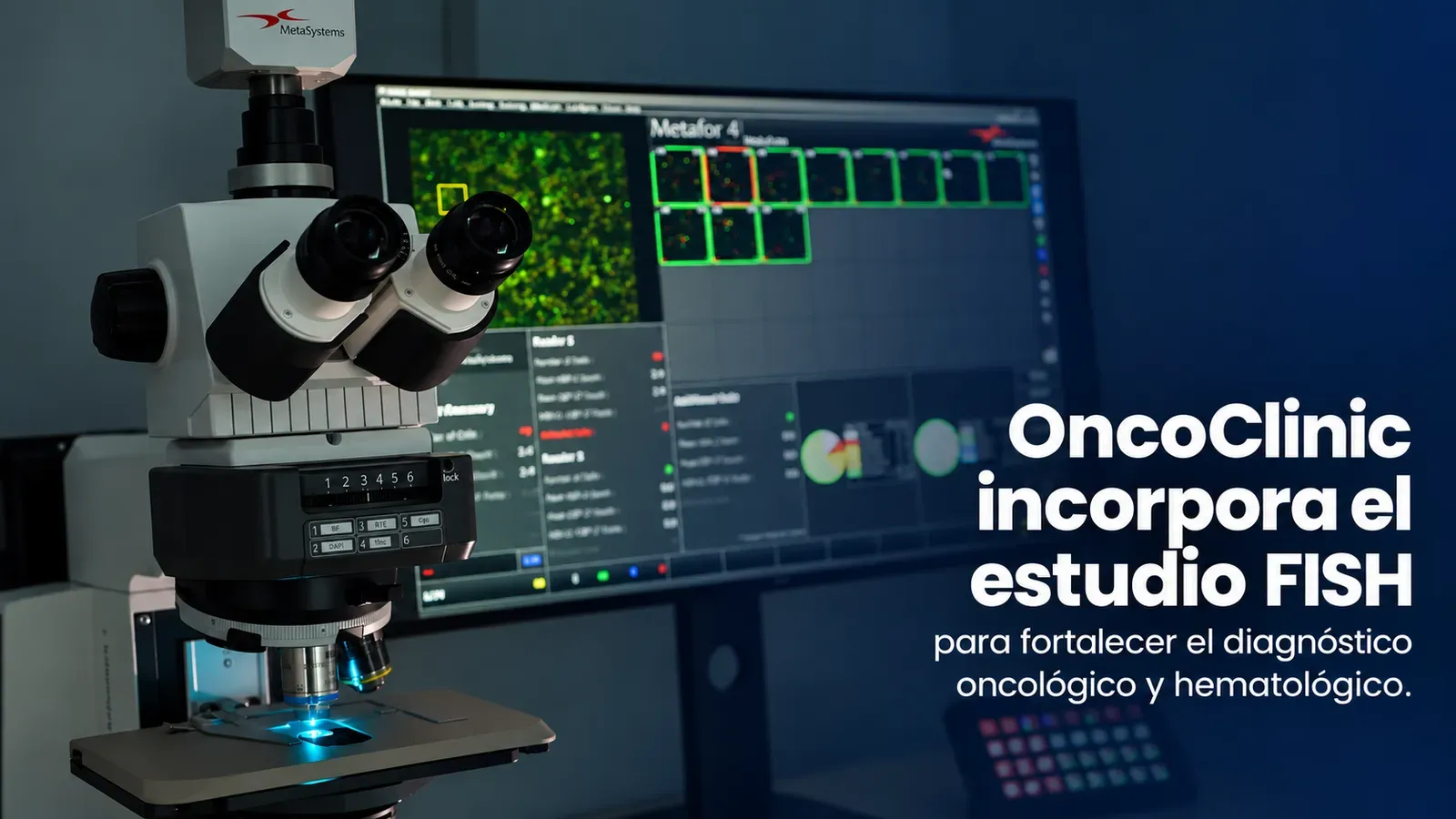 OncoClinic incorpora el estudio FISH para fortalecer el diagnóstico oncológico y hematológico Microscopio para estudio FISH