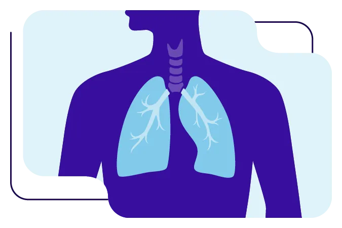 Cancer de Pulmon