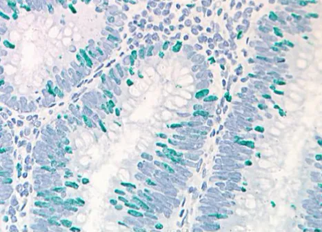 Inmunohistoquimica