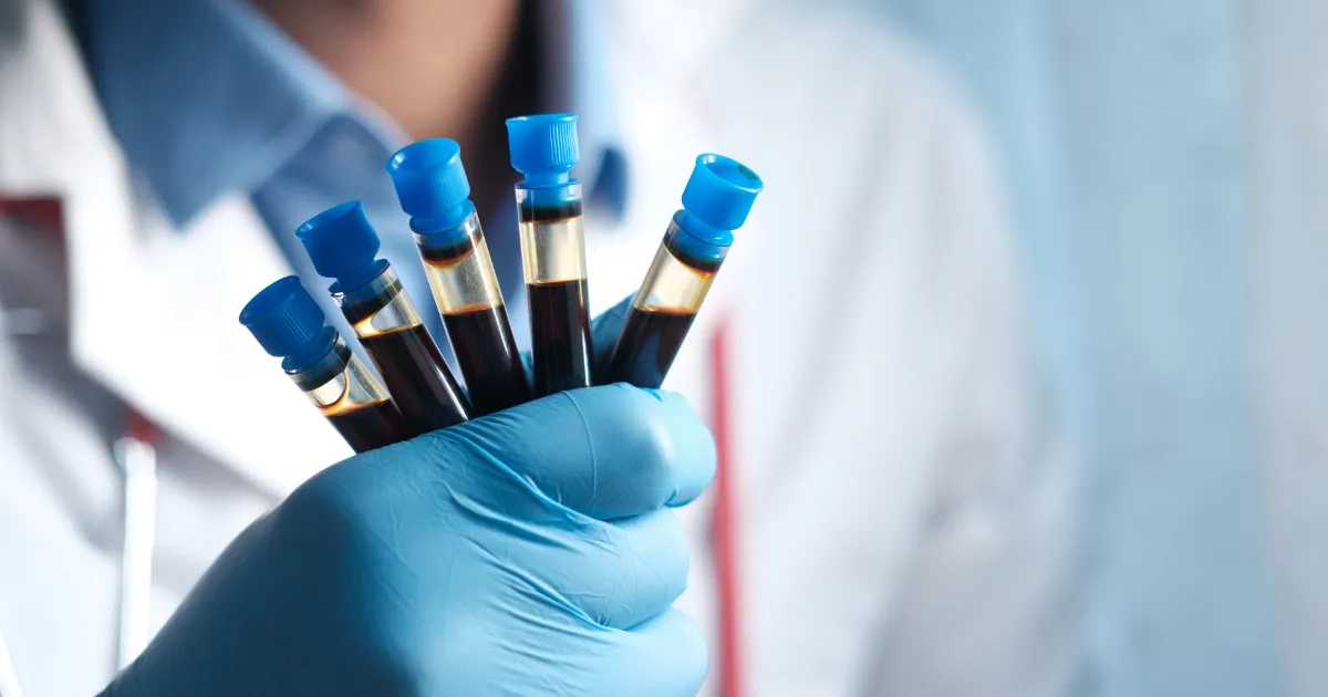 La prueba BRCA evalúa si una persona heredó mutaciones que aumentan el riesgo de cáncer de mama, ovario u otros tipos. Identificar estas alteraciones permite tomar decisiones preventivas o de tratamiento antes de que aparezca la enfermedad.