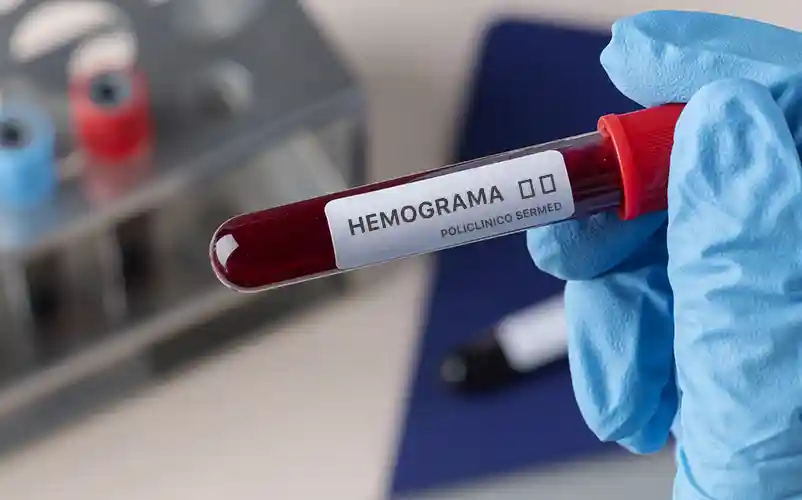 La importancia del hemograma: lo que tu sangre puede revelar