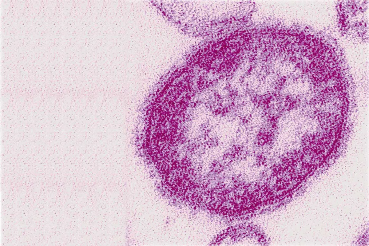 El virus del sarampión es un paramixovirus, del género Morbillivirus.