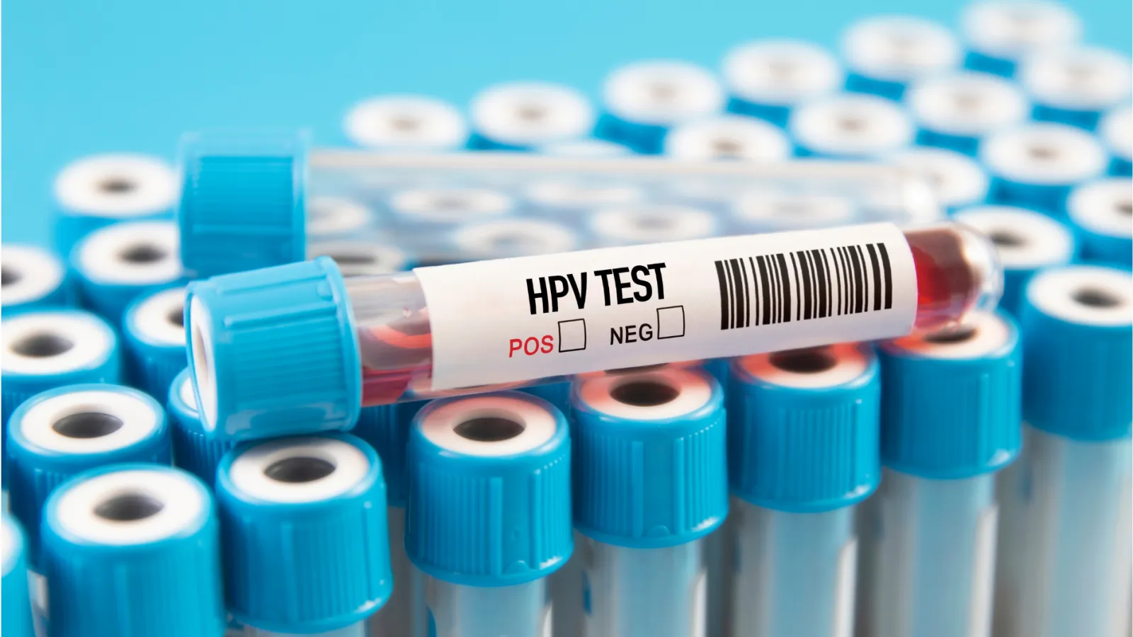 El VPH puede permanecer en el cuerpo sin causar molestias. El VPH puede permanecer en el cuerpo sin causar molestias.