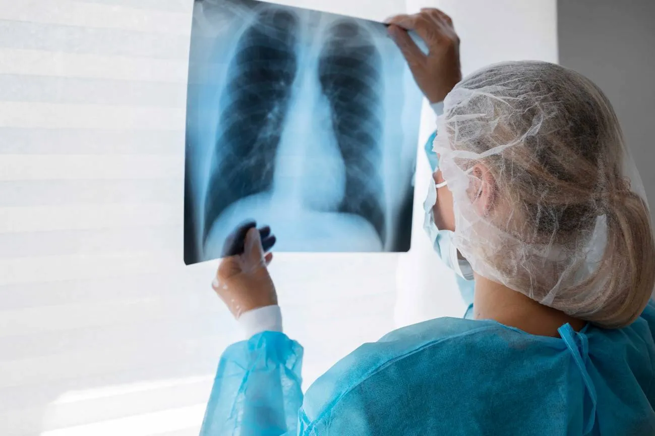 cancer de pulmon en radiografia