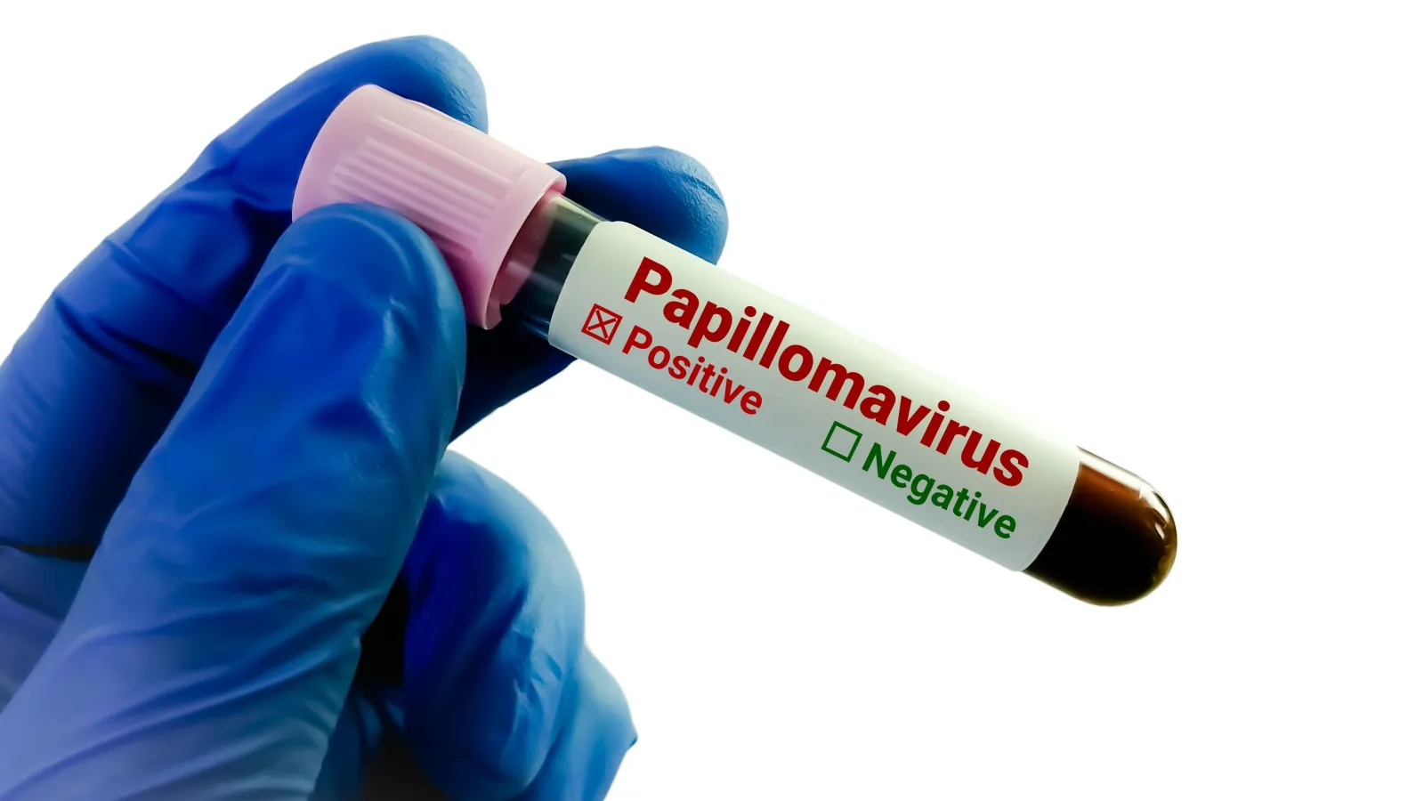 Test HPV