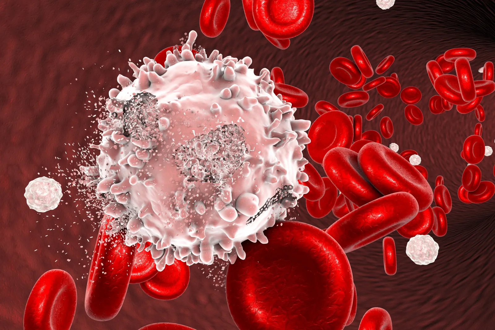 Cánceres de la sangre: qué son y cómo detectarlos a tiempo