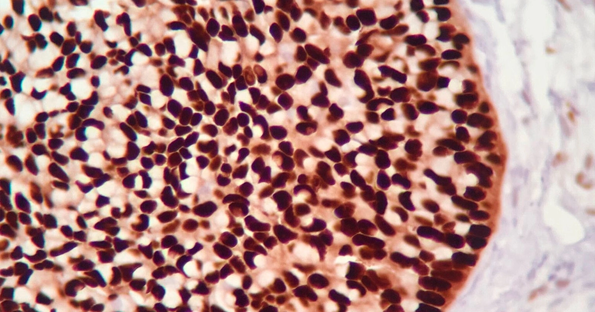 Laboratorio de Inmunohistoquímica