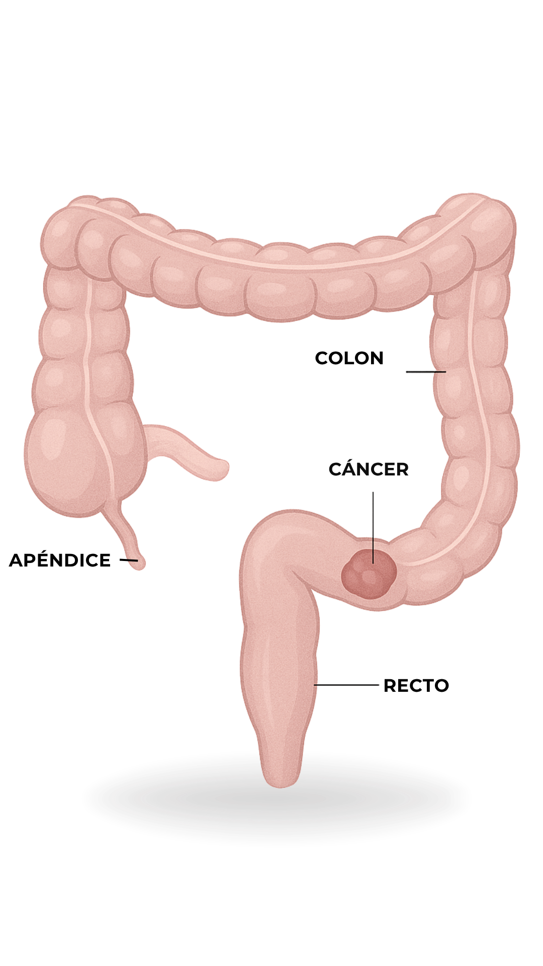 Anatomía - Cáncer Colorrectal