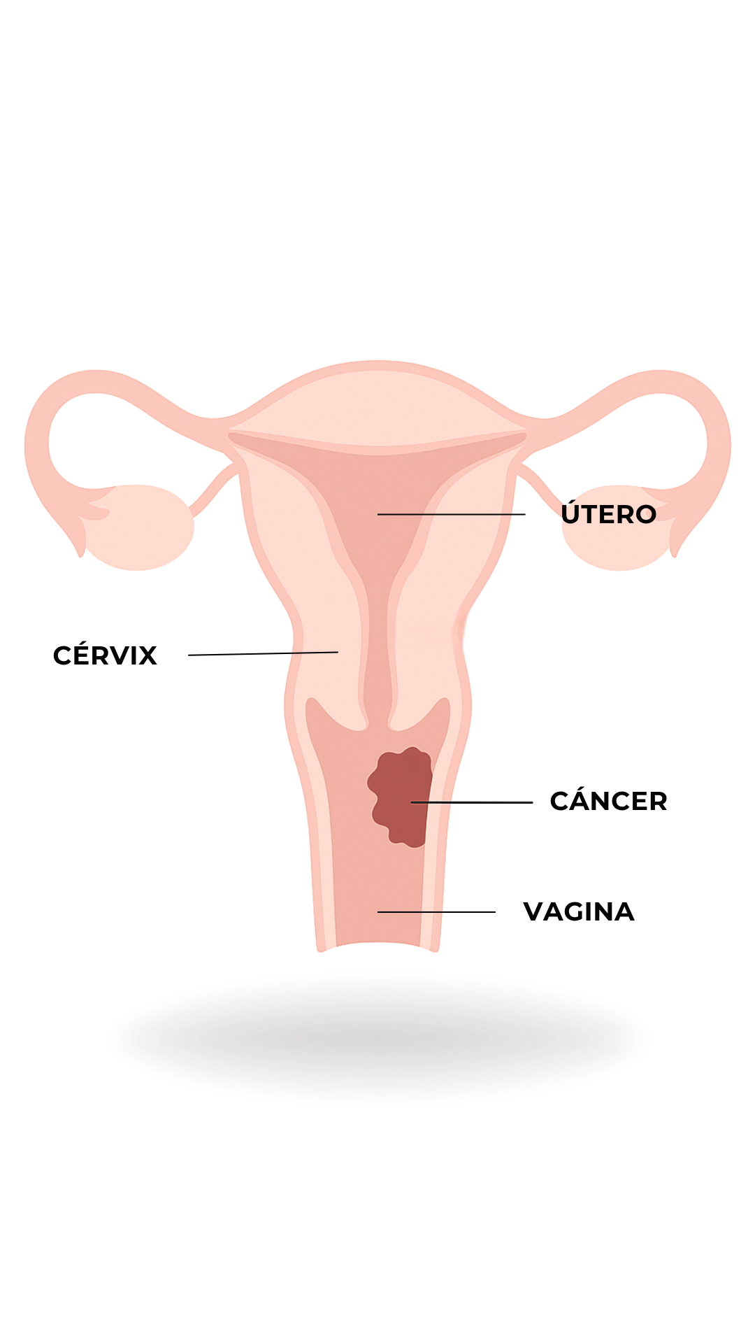 Anatomía - Cáncer de Cuello Uterino