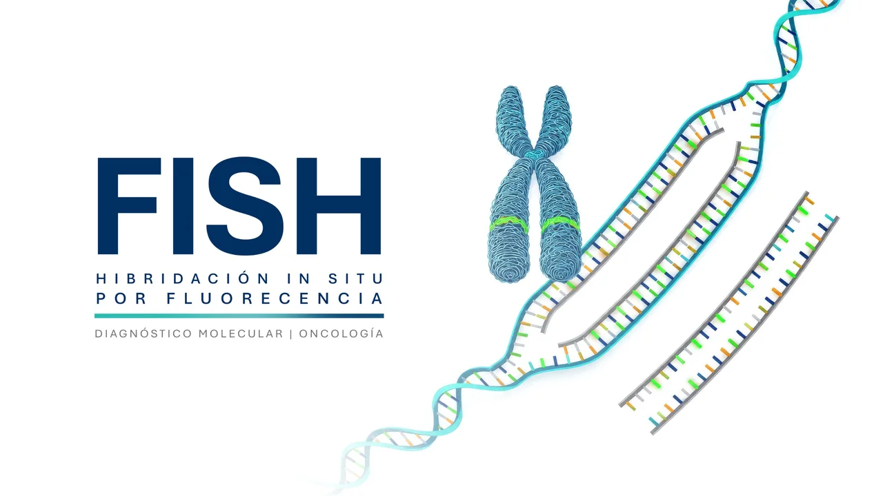 FISH: hibridación in situ por fluorescencia. Identidad de diagnóstico molecular y oncología, con cromosoma y ADN.